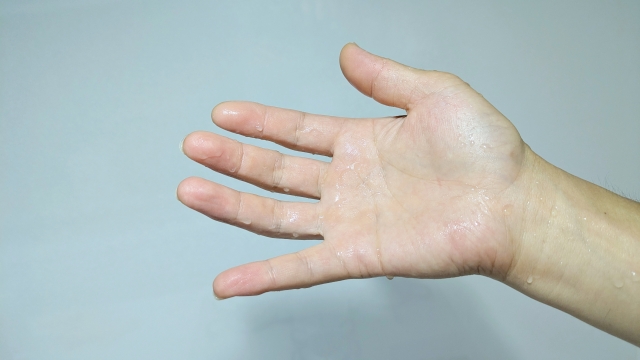 多汗症（汗かき）・脇汗の治療