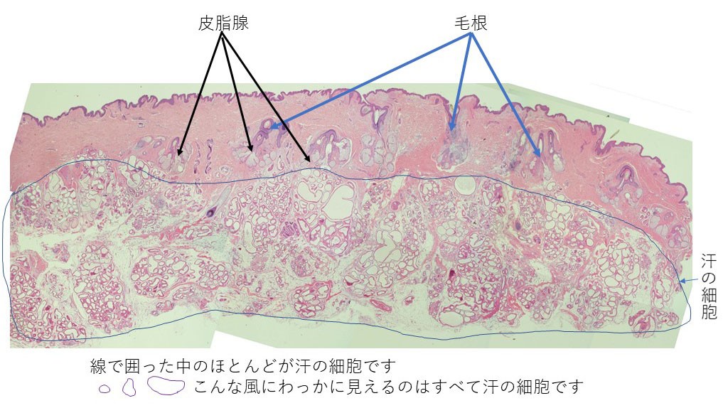 治療を受ける前の私のわきの下の皮膚