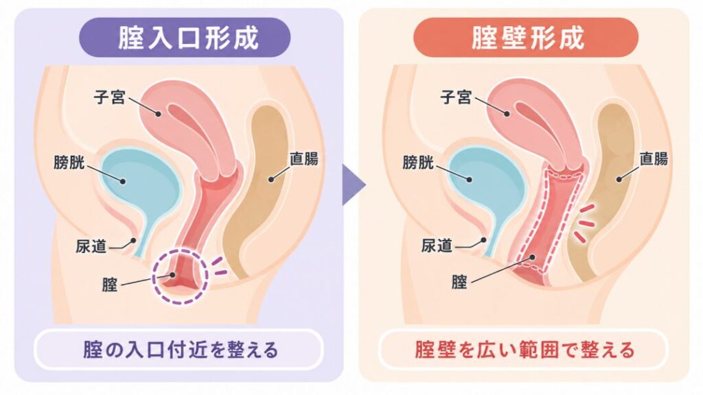 切開法による腟縮小術で行うこと