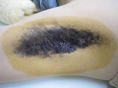 【写真1:治療前】